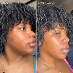Dermisa Fade Cream lightweight formula with daily hydration