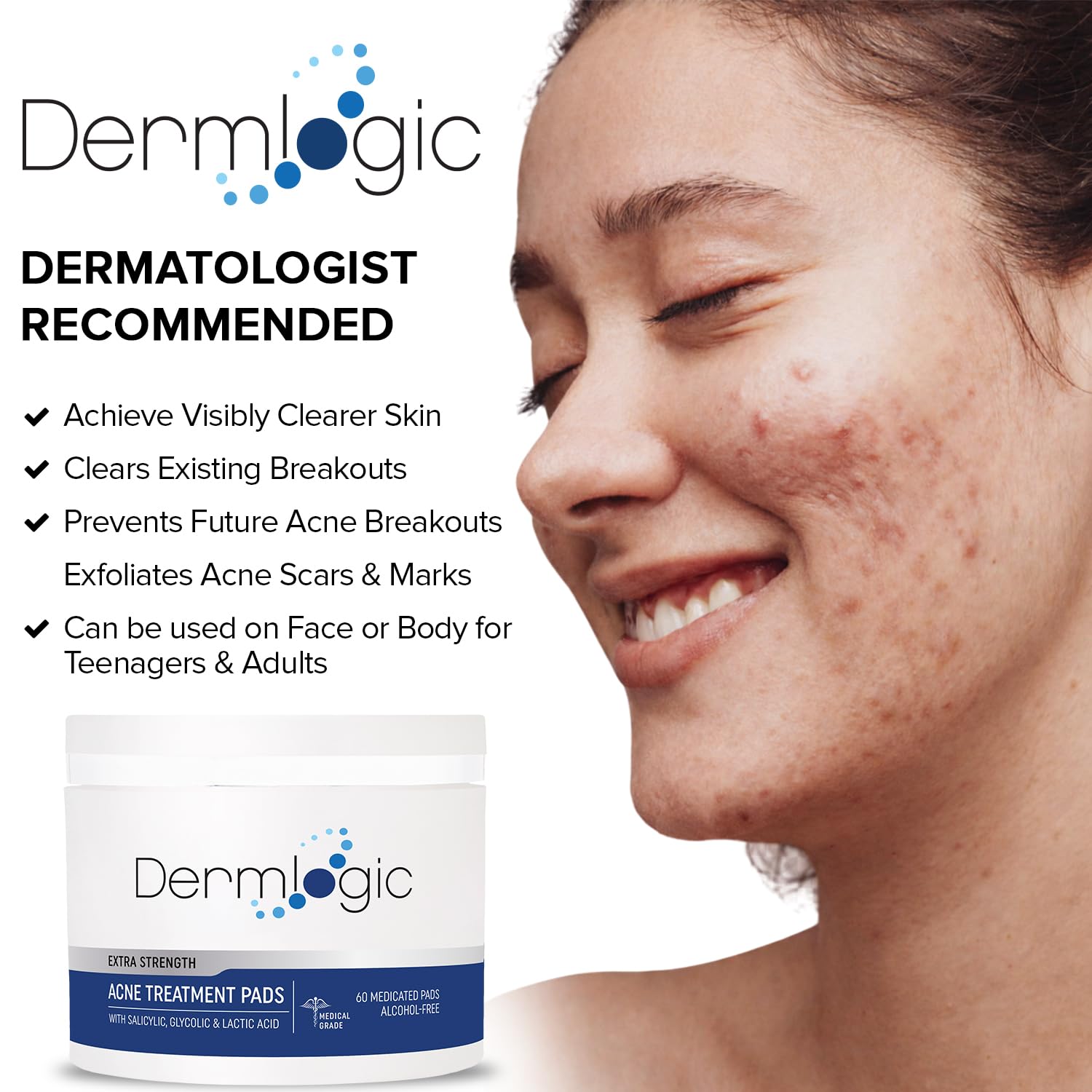 Dermlogic acne pads in use with wipe motion to clear pores