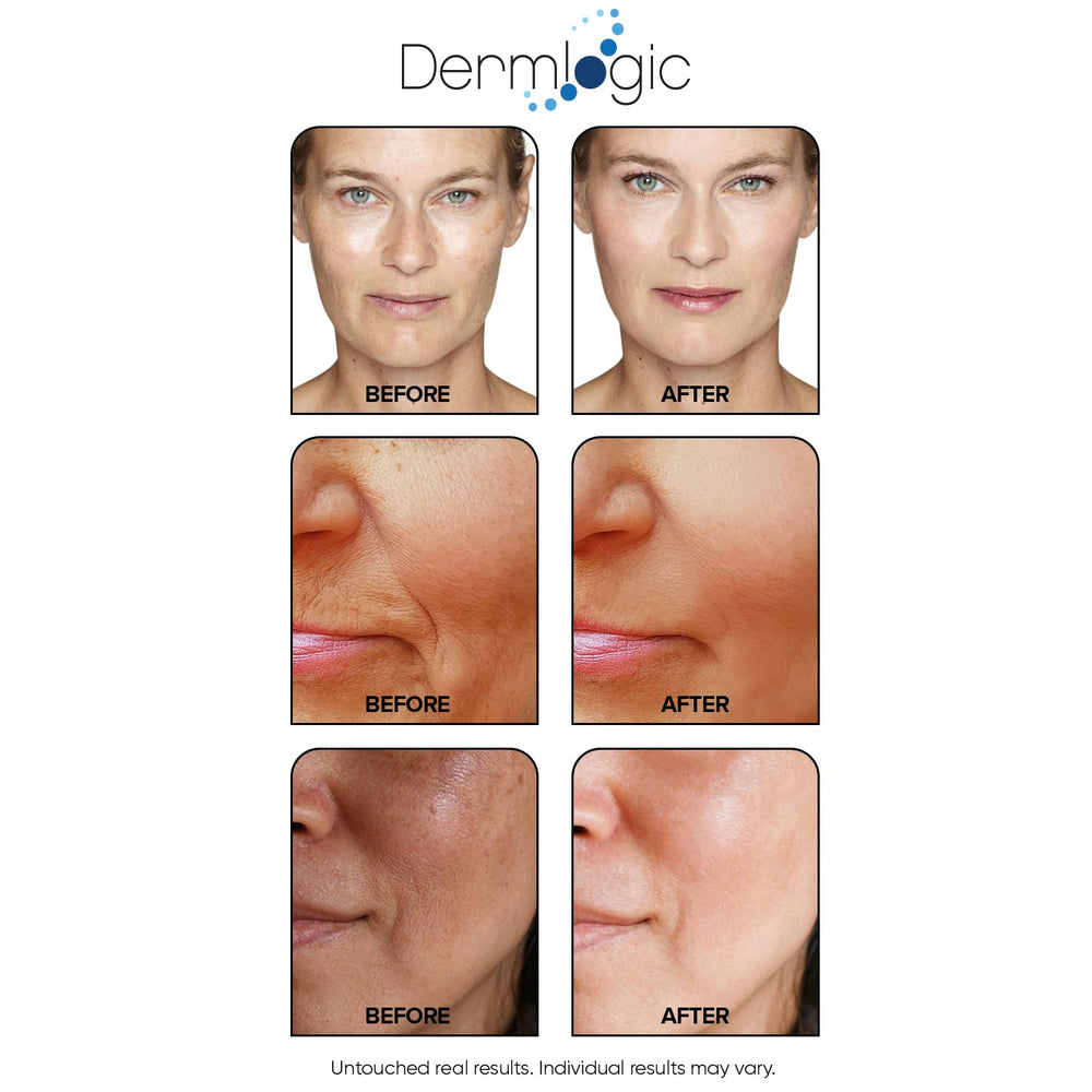 Dermlogic pore-refining exfoliation pad highlights refined pores and clearer skin.