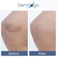 The packaging box of Dermlogic Vitamin K Cream is displayed with ingredient details.