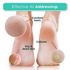 DERMORA Foot Peel Mask ingredient blend close-up shows fruit acids and extracts
