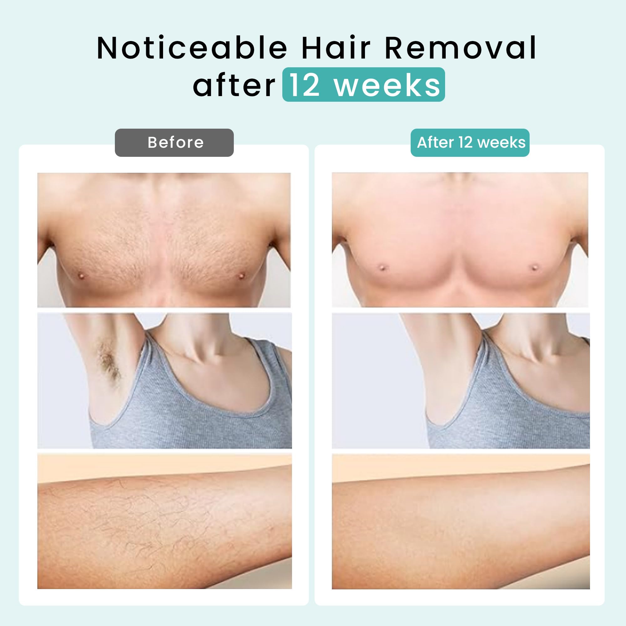 DermRays IPL Hair Removal device shows wavelength range for effective pulses.