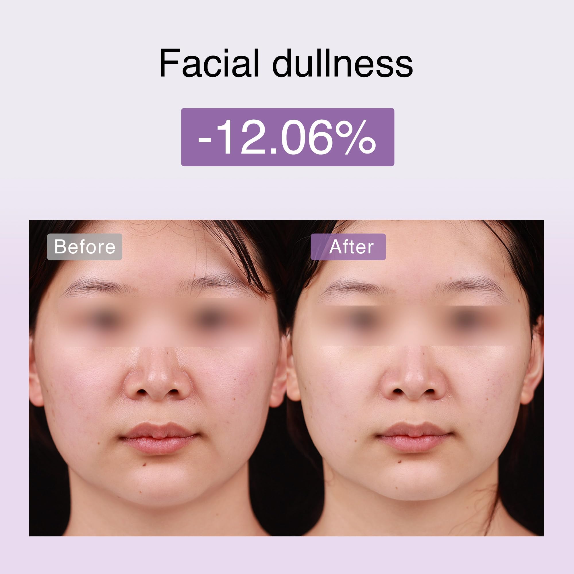 DermRays M1 LED light and vibrations enhance skincare absorption