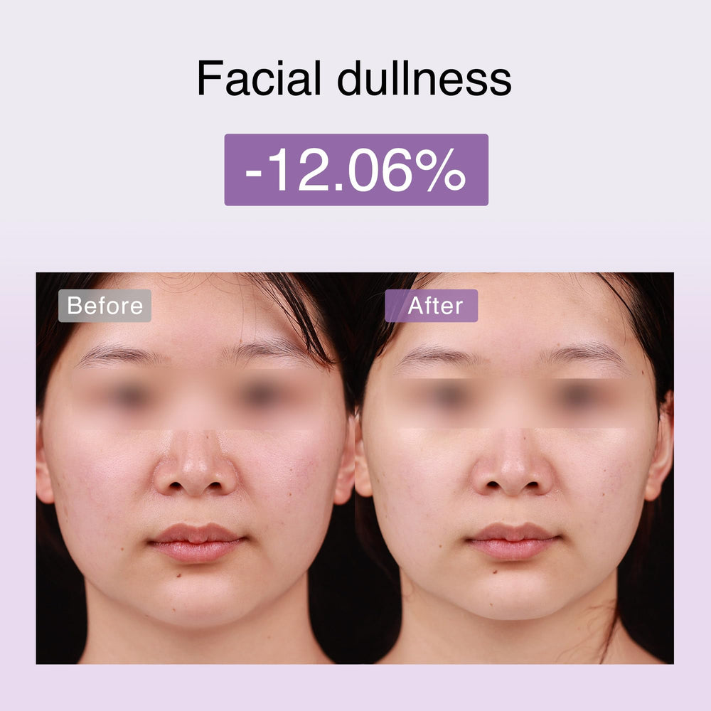 DermRays M1 LED light and vibrations enhance skincare absorption