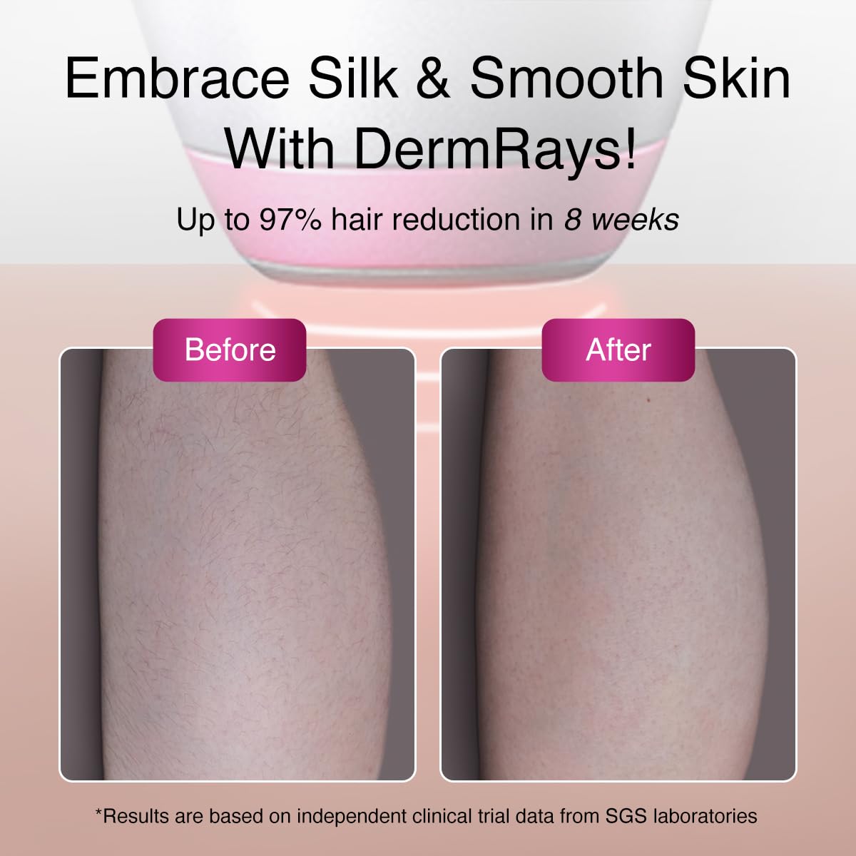DermRays V6S adjustable levels tailor intensity to skin tone and hair type.