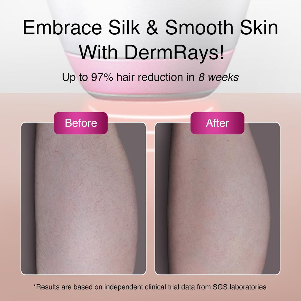 DermRays V6S adjustable levels tailor intensity to skin tone and hair type.