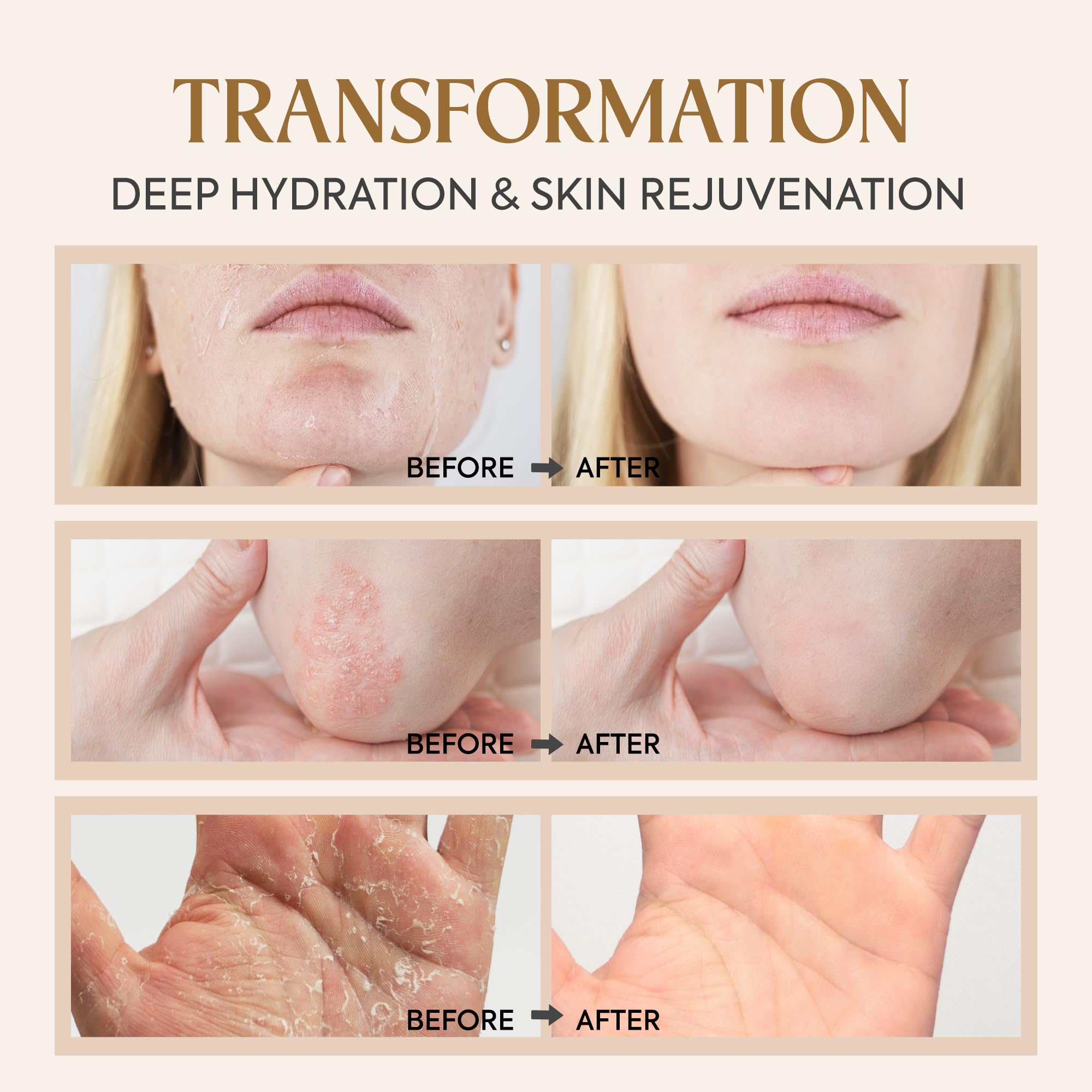 Dersie baby-safe balm is suitable for delicate skin areas.