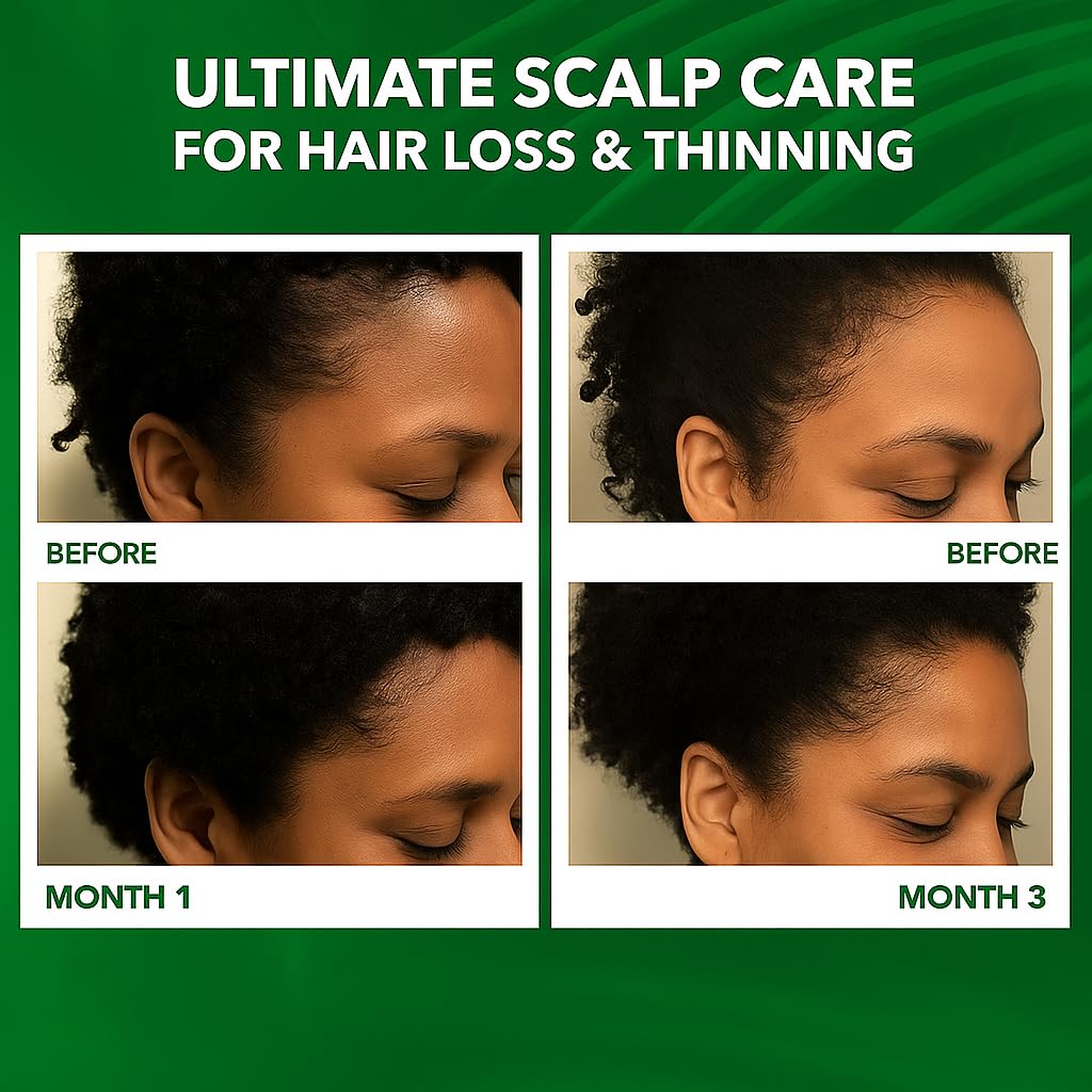 Dersie Scalp Oil calms dry, itchy scalp with tea tree and peppermint.