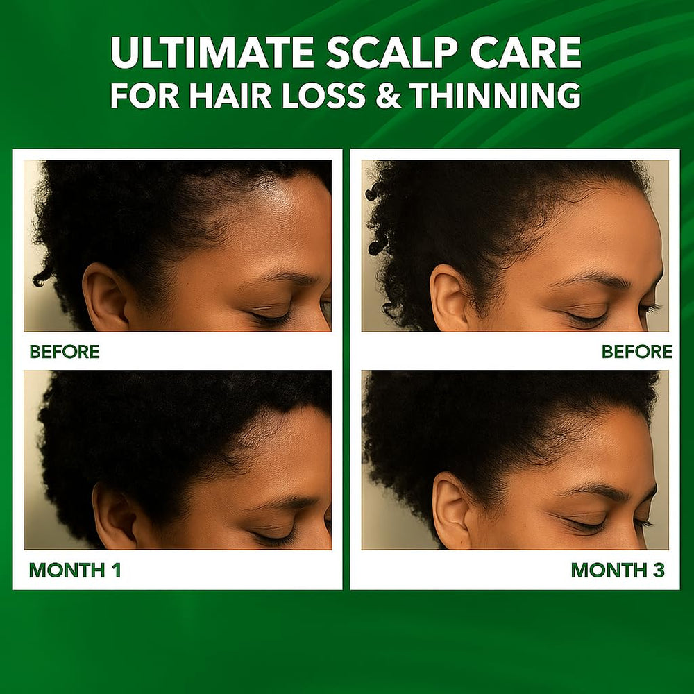 Dersie Scalp Oil calms dry, itchy scalp with tea tree and peppermint.