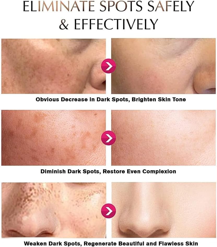Deuiosna Snow Bleach Cream elbows image for smoothness and moisture
