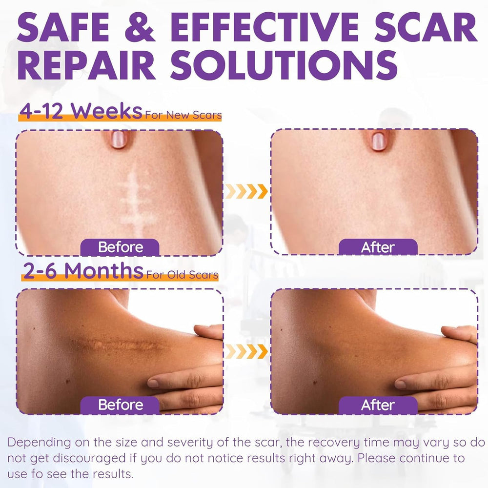DFK scar tape for keloid helps discreet wear and scar visibility management