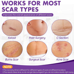 DFK silicone scar tape application shows flexible fit for healing skin