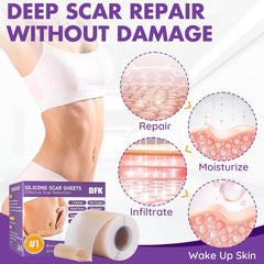 DFK soft silicone scar strips provide comfortable scar management