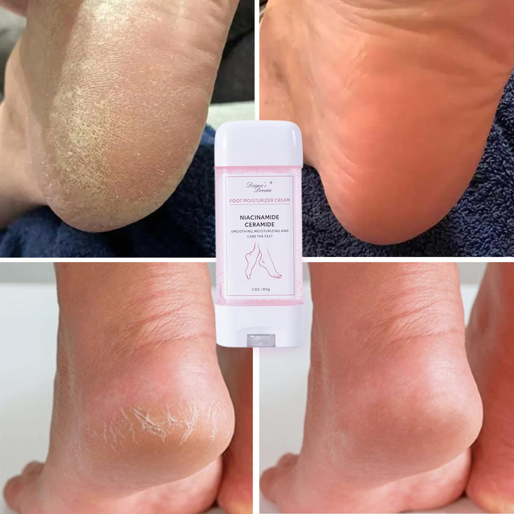 Diana's Dream application routine on feet for daily care.