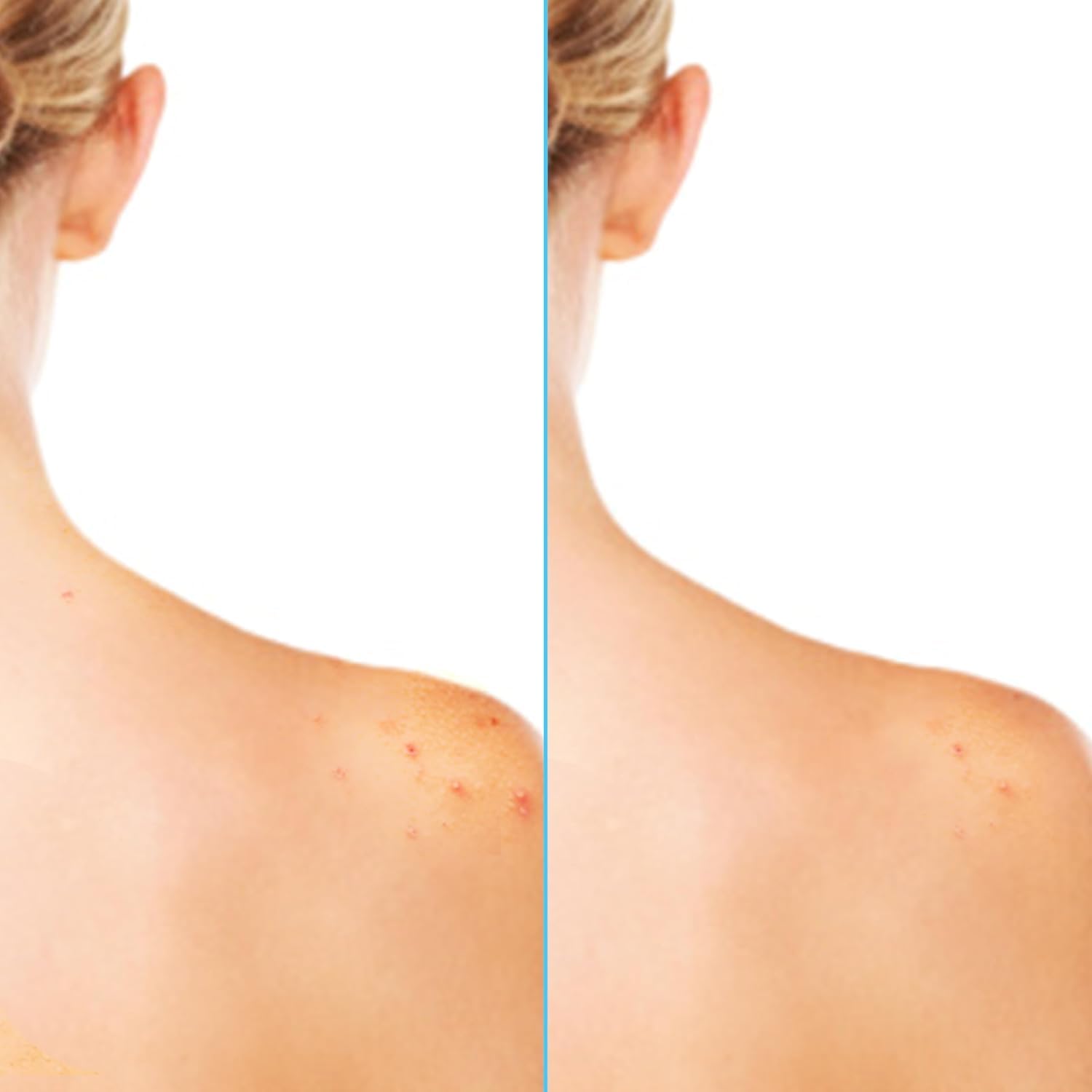 Label on Differin Acne-Clearing Body Spray highlighting active ingredients