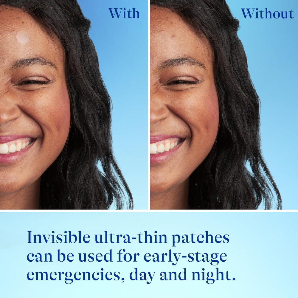 Differin Acne Patches small patch for precise spot coverage
