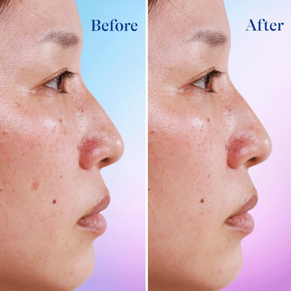 Citric acid in Differin serum suggests gentle surface renewal for luminosity.