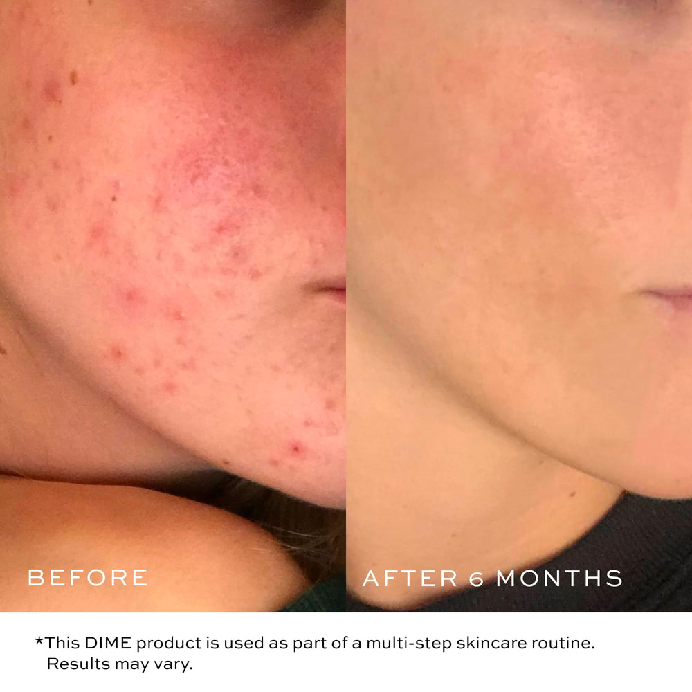 DIME Gentle Jelly Cleanser vitamin E and lycopene nourish while cleansing.