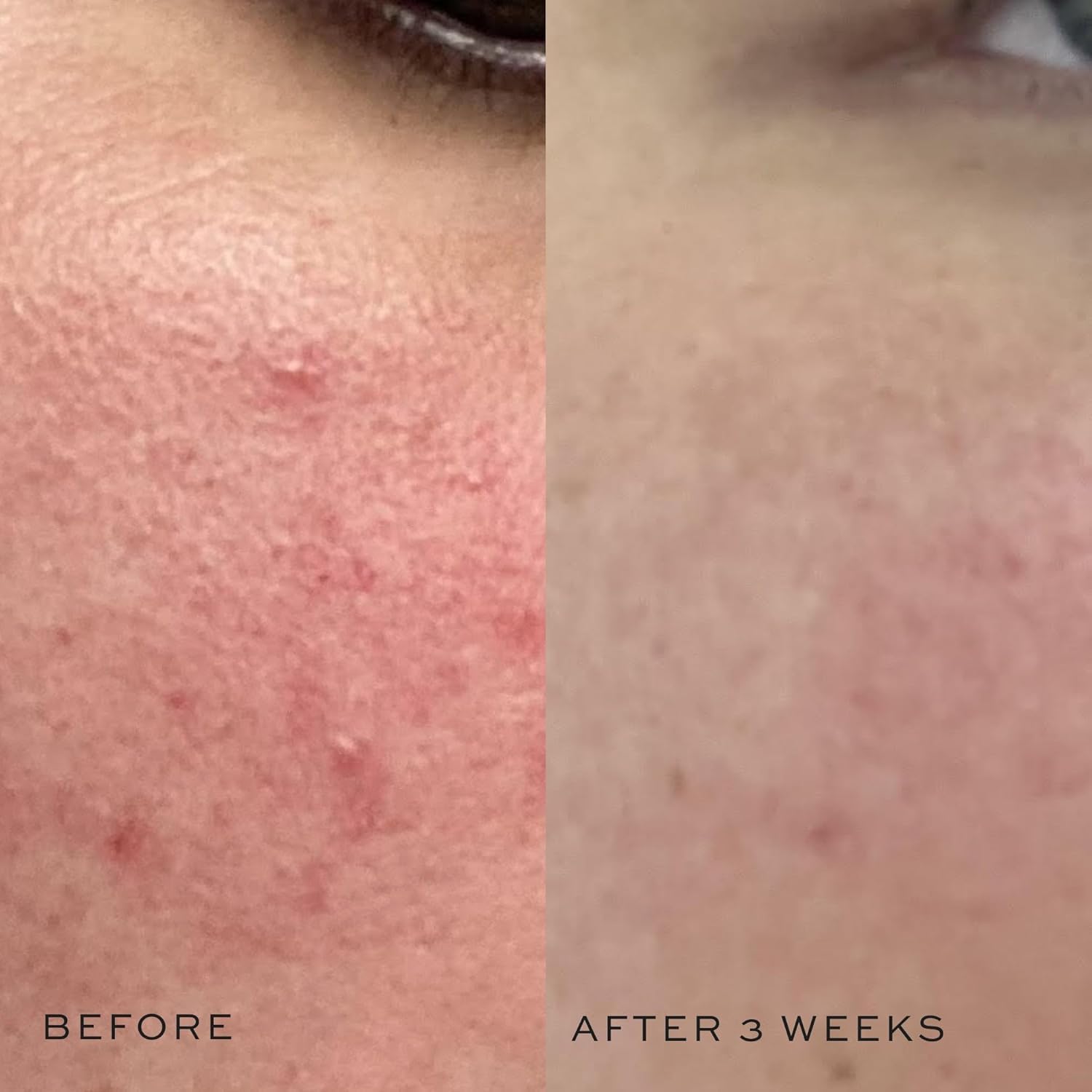 DIME Super Skin Toner applied with cotton pad to refresh the face.