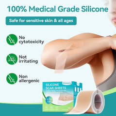 Dimora cut-to-fit silicone scar sheet, easy customization for different scar shapes.