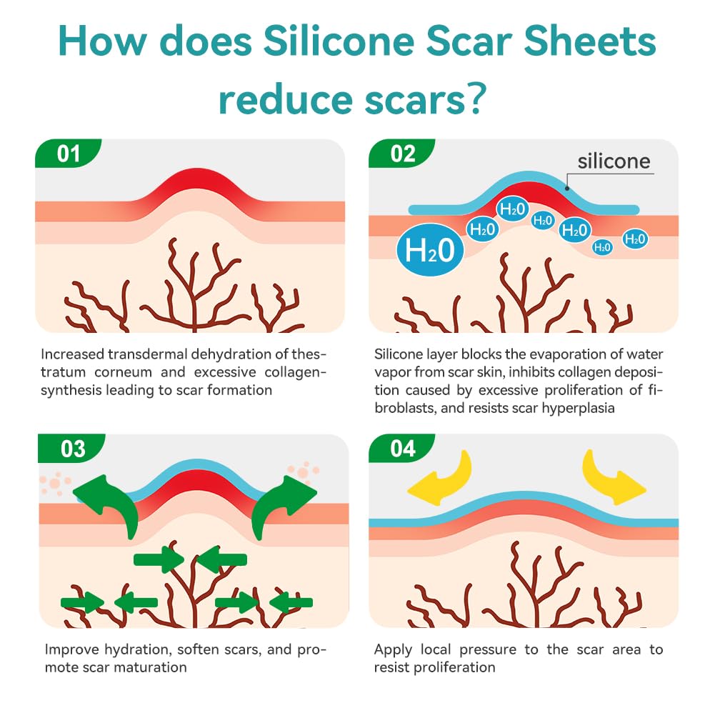 Dimora cuttable scar tape; customize fit for different scars.