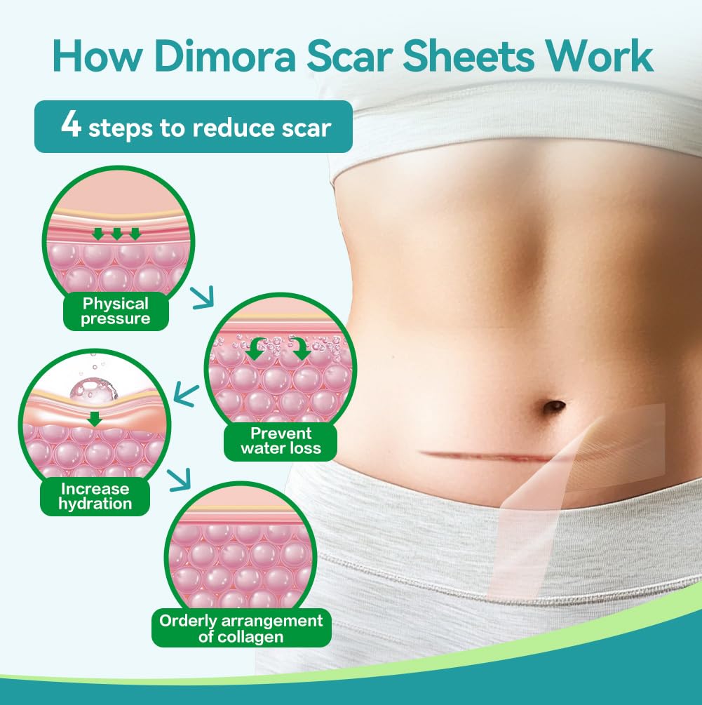 Dimora hypoallergenic silicone material, suitable for sensitive skin and all ages.