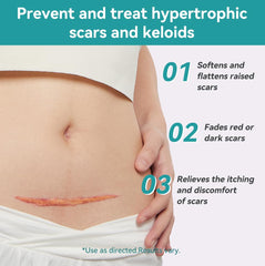 Dimora silicone scar sheets on skin during application; comfortable fit.