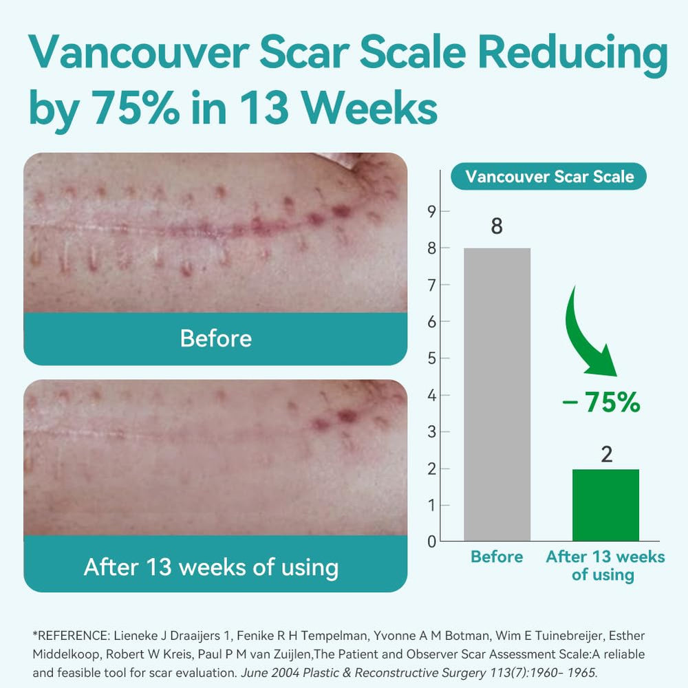 Dimora silicone scar tape on skin, comfortable wear during daily activities.