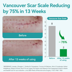 Dimora silicone scar tape on skin, comfortable wear during daily activities.