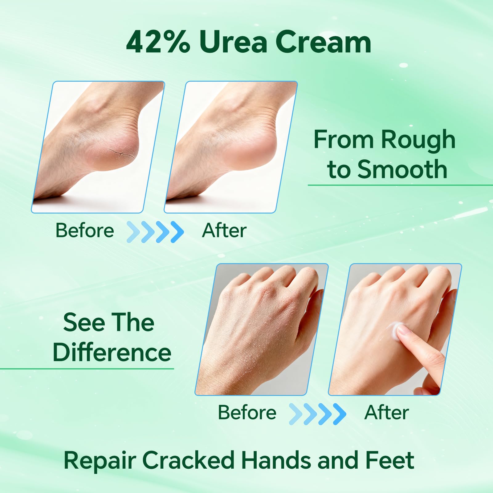 Discoliner multi-use cream for elbows and knees.
