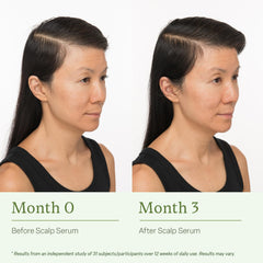 Divi Healthy Hair Goals Mini Kit packaging shows complete routine