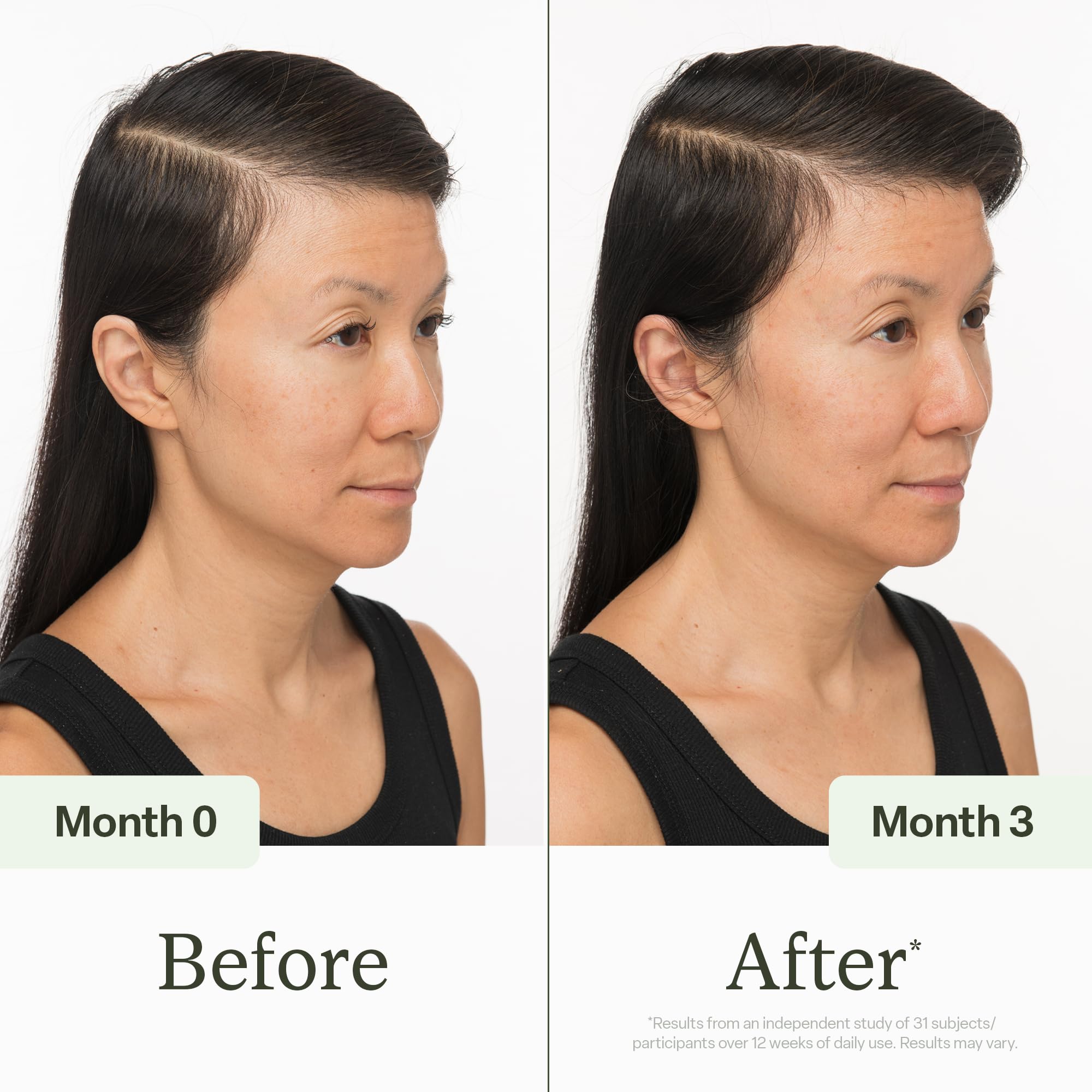 Divi Scalp Serum on the scalp during massage promotes nourishment