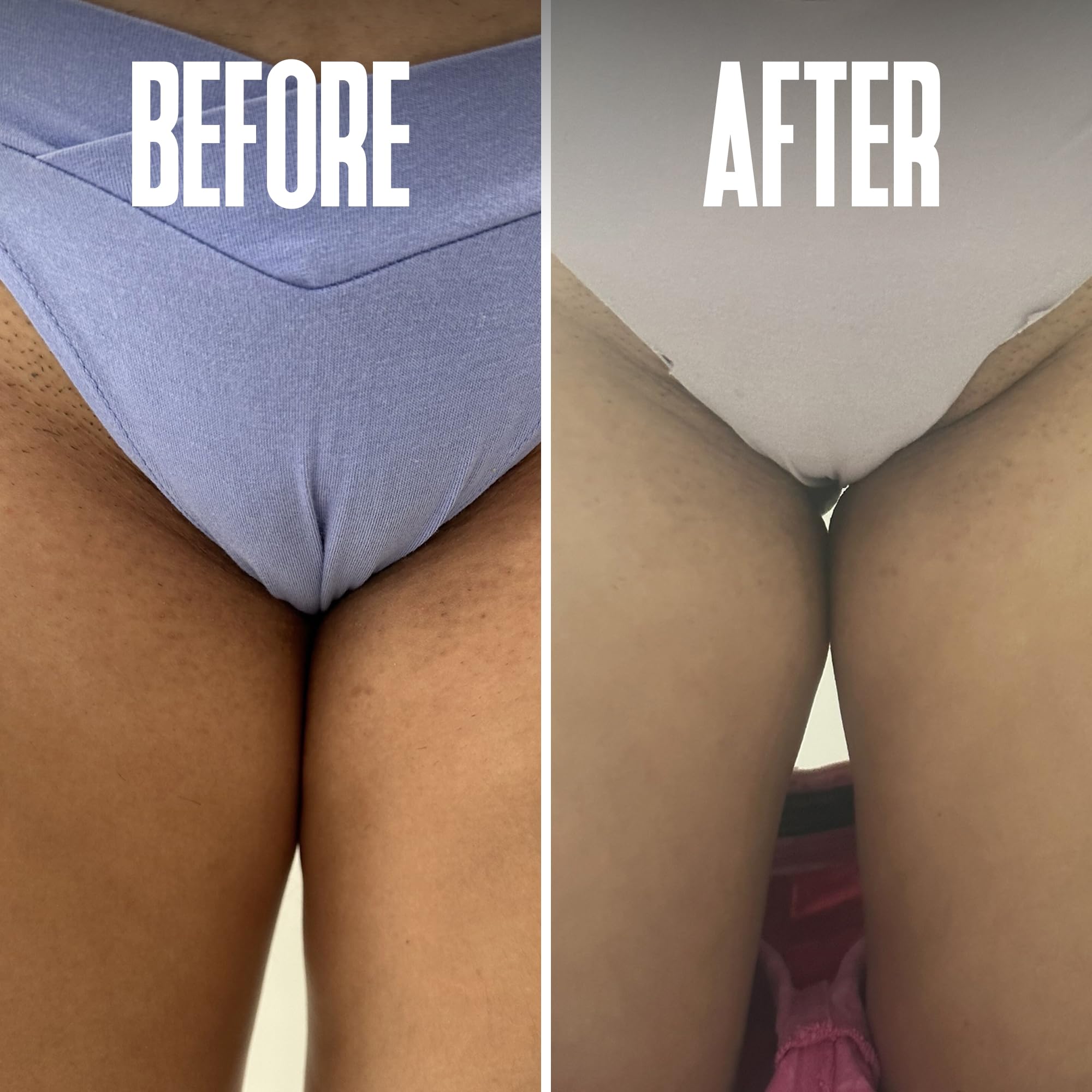 Divine Derriere pads contain glycolic and salicylic acids