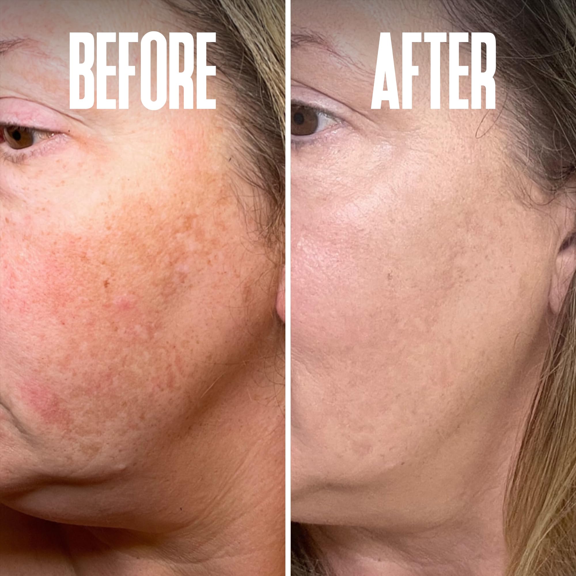 Divine Derriere plant-extracts peptides visual emphasizes Tyrostat HR and 5-Melanostatine support.