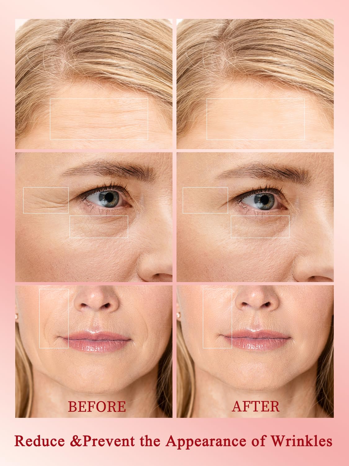 Divmceknyy base gel bottle supports improved RF energy delivery during treatments.
