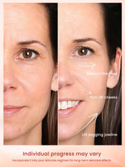 Divmceknyy device glide head close-up showing smooth contouring during treatment.