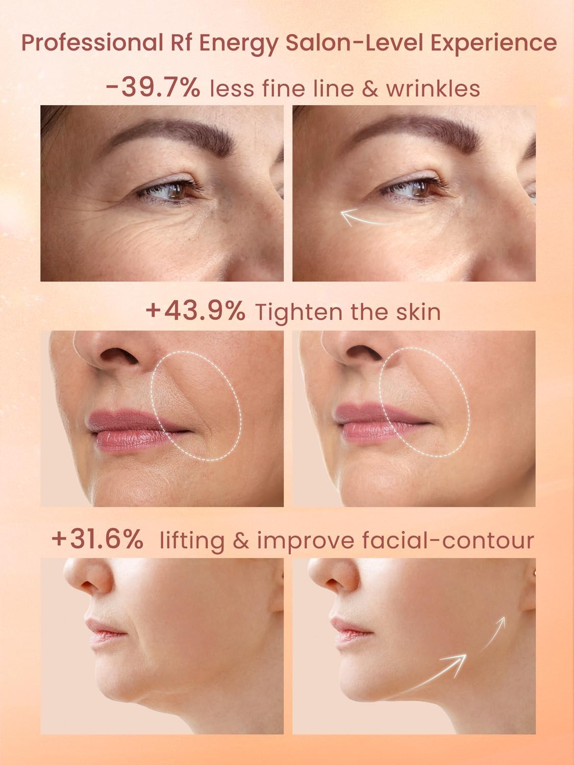 Divmceknyy RF face device three modes for targeted eye, brow, and jawline care.