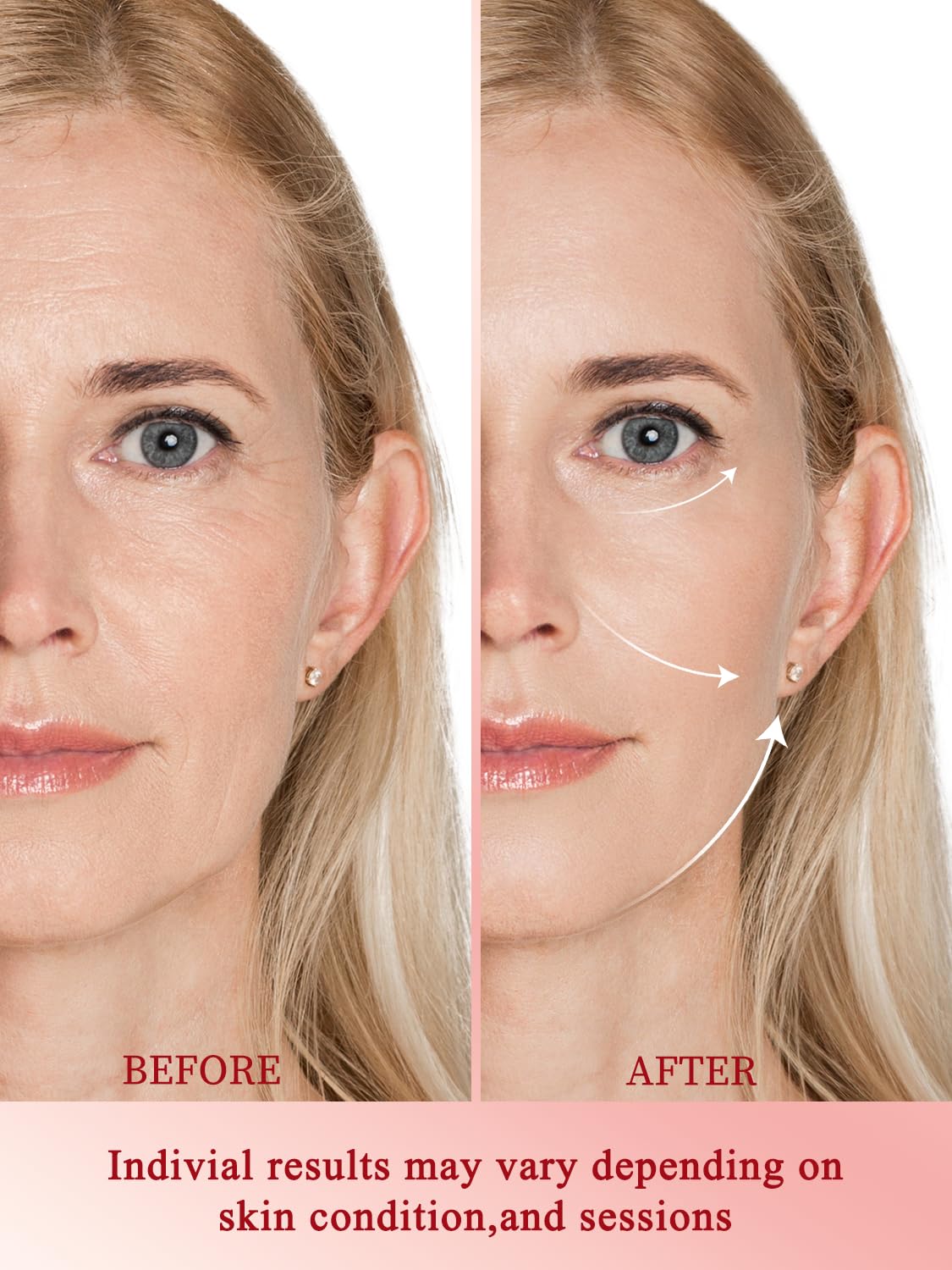 Divmceknyy zoned care heads target eyes, cheeks, and jawline for focused results.