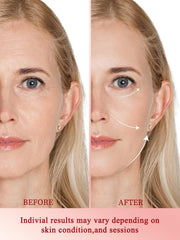 Divmceknyy zoned care heads target eyes, cheeks, and jawline for focused results.