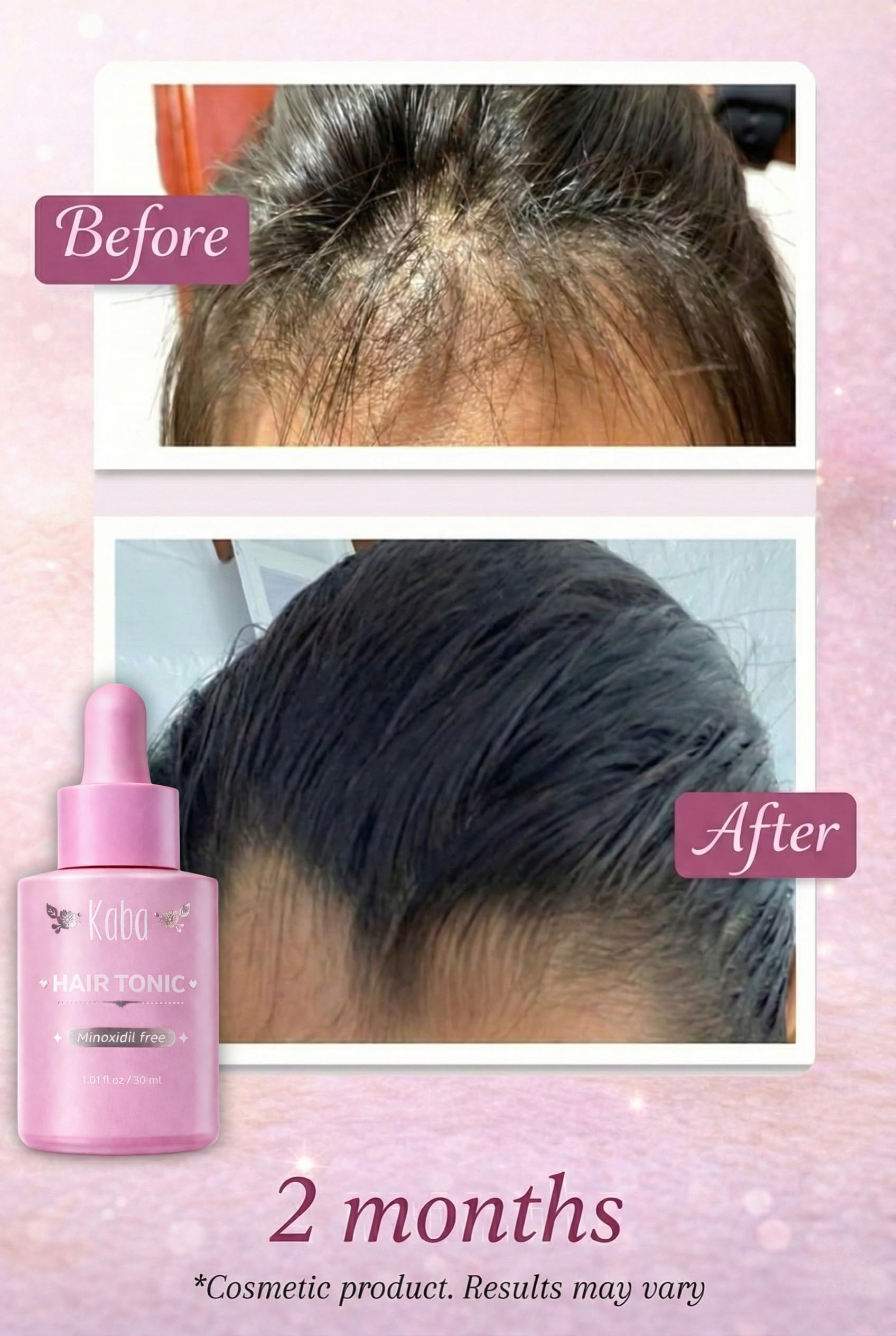 D'Luchi Kaba hair-growth-oil hands applying to scalp for nourishment