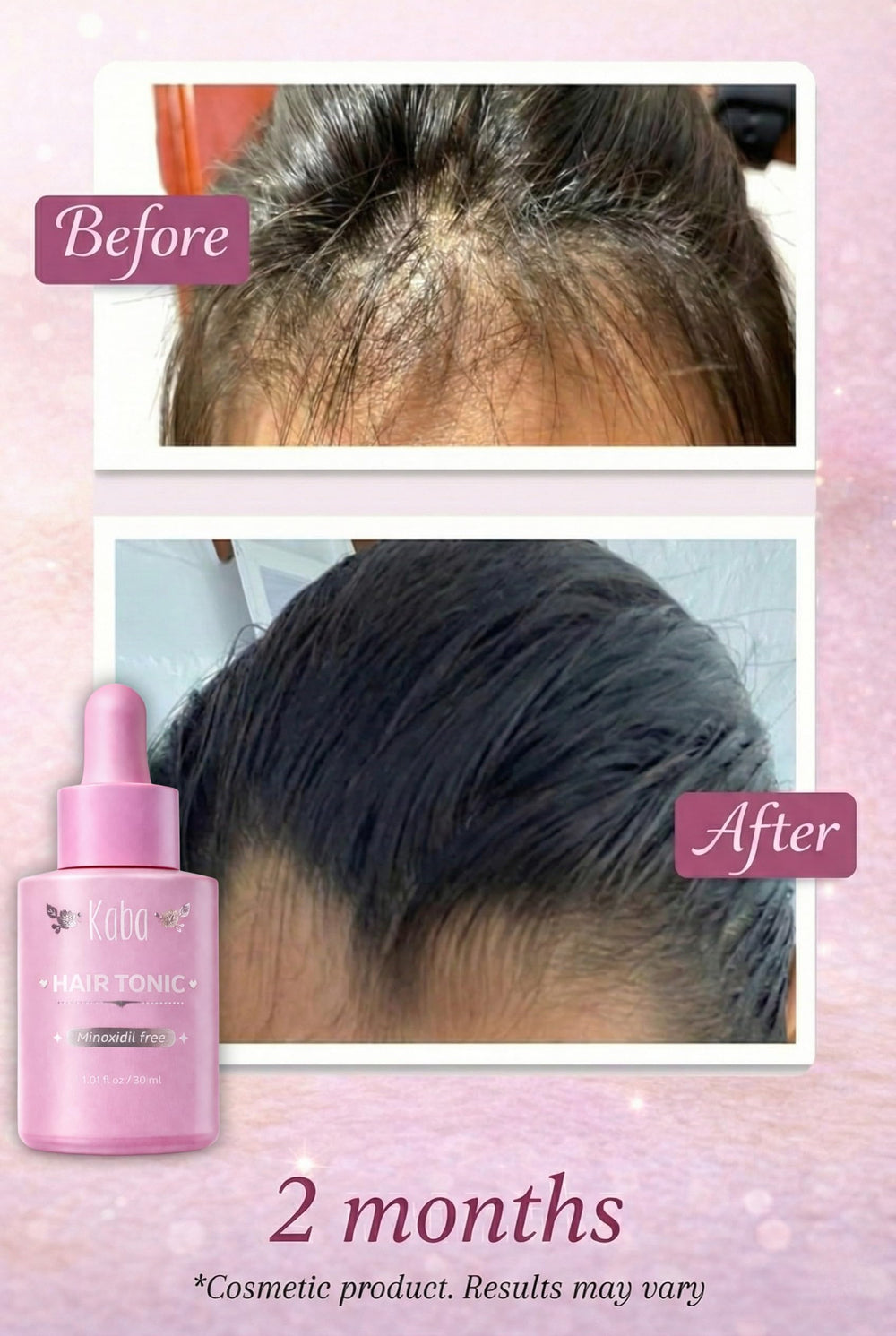 D'Luchi Kaba hair-growth-oil hands applying to scalp for nourishment