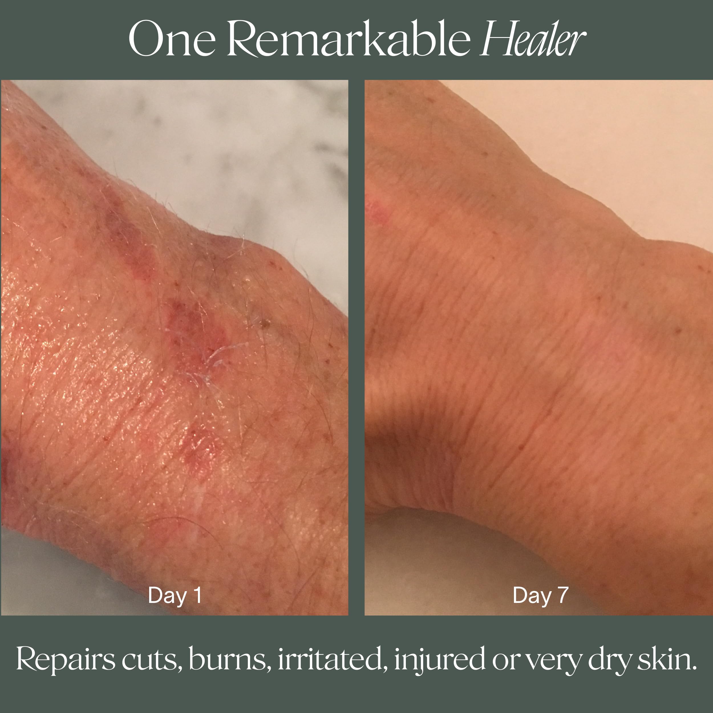 Doctor Rogers Restore Healing Balm feet care shot highlights repair for dry, rough skin