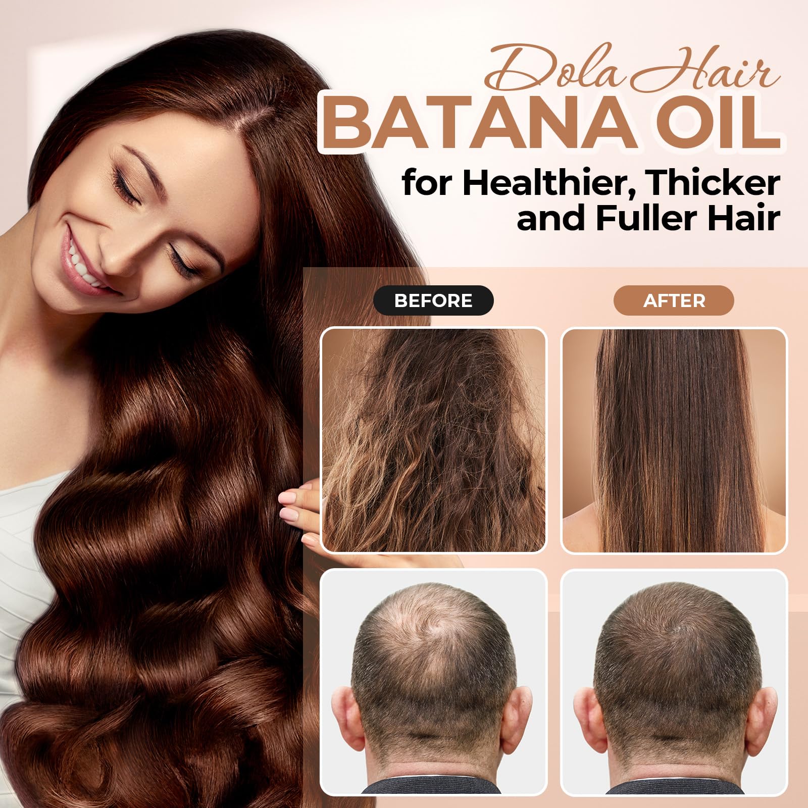 Dolahair Batana Oil hands applying on scalp for nourishment