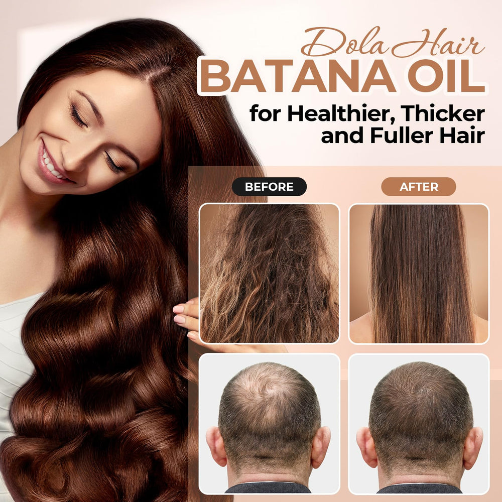 Dolahair Batana Oil hands applying on scalp for nourishment