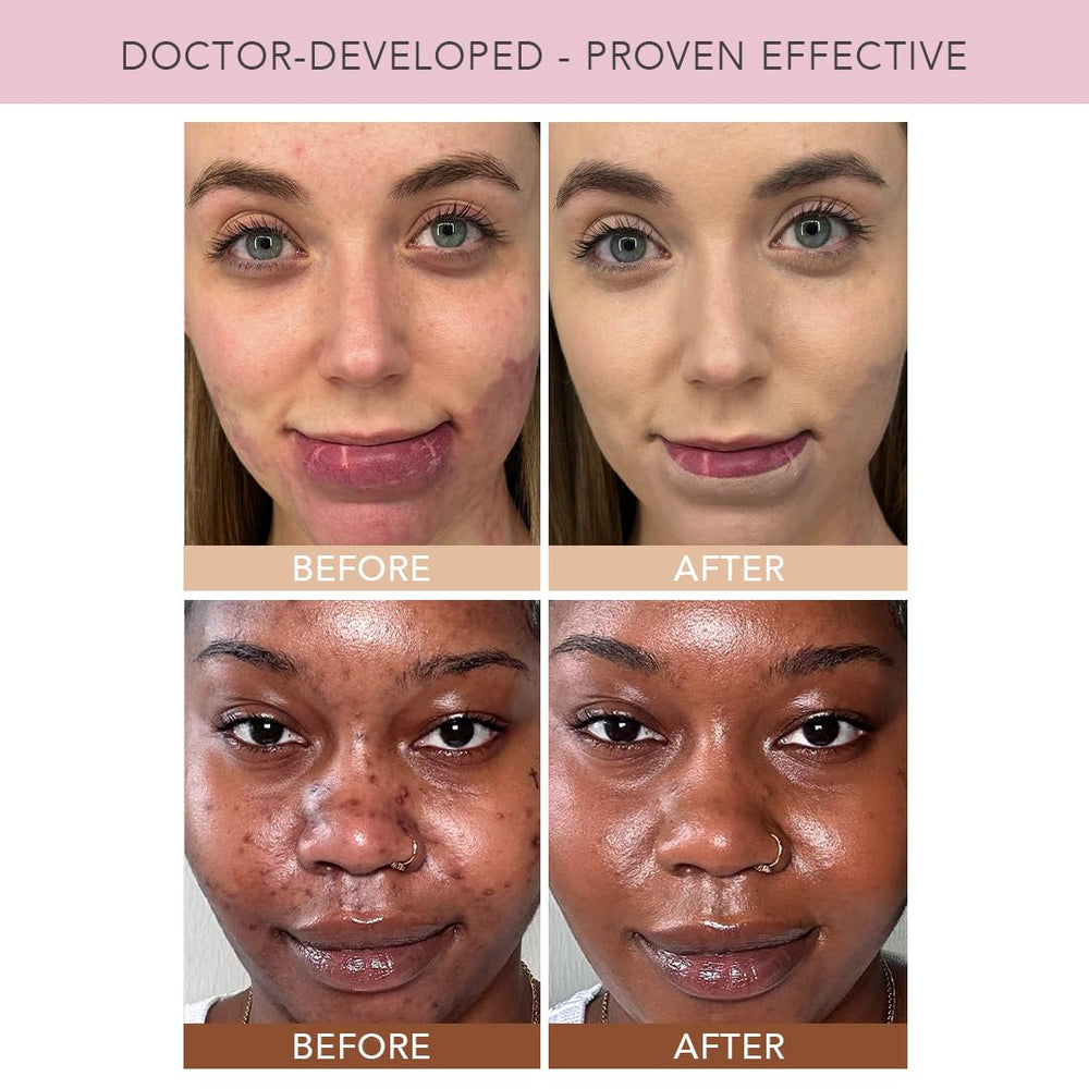 DOLL 10 NO TCE Liquid Filter swatch on arm shows customizable sheer to moderate tint.