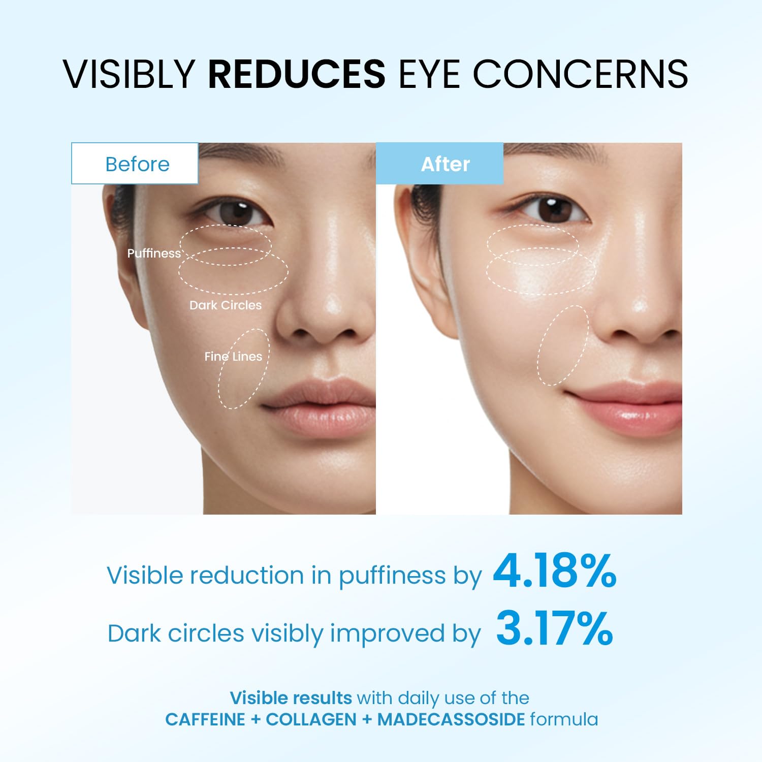 Dongyu caffeine under-eye cream packaging highlighting premium skincare
