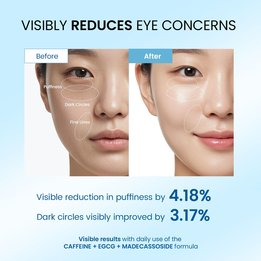 Dongyu Eye Cream rollerball application showing easy, soothing massage for puffy eyes.