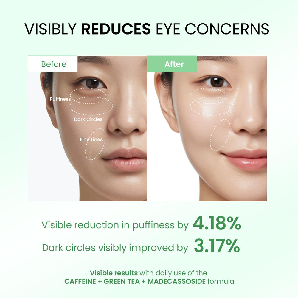 Dongyu Eye Cream rollerball application provides cooling massage and quick absorption