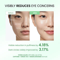 Dongyu Eye Cream rollerball application provides cooling massage and quick absorption