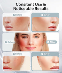 Dopsikn therapy targets eye-area with gentle light for youthful look